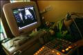 Ultrasound of Pregnant Woman - Baby Prolife